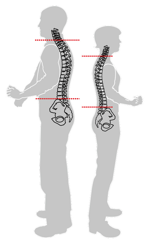 Medición de la longitud de espalda